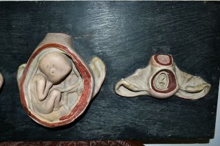 Antique Plaster/Papier Mâché Section Anatomical Model.  Womb with the fetus.  1930s 4
