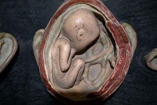 Antique Plaster/Papier Mâché Section Anatomical Model.  Womb with the fetus.  1930s 5