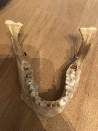REAL Human Skull Medical Dental Teaching Training Vintage rare And Old 10