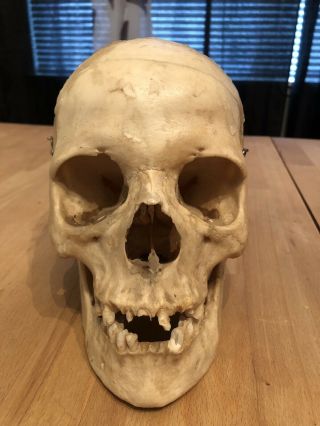 REAL Human Skull Medical Dental Teaching Training Vintage rare And Old 2