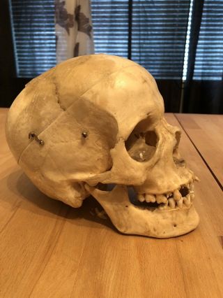 REAL Human Skull Medical Dental Teaching Training Vintage rare And Old 3