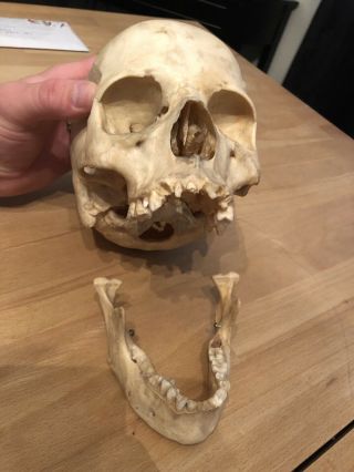 REAL Human Skull Medical Dental Teaching Training Vintage rare And Old 4