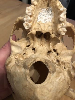 REAL Human Skull Medical Dental Teaching Training Vintage rare And Old 5