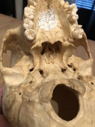 REAL Human Skull Medical Dental Teaching Training Vintage rare And Old 6
