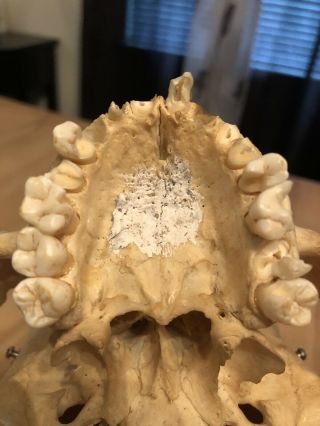 REAL Human Skull Medical Dental Teaching Training Vintage rare And Old 7