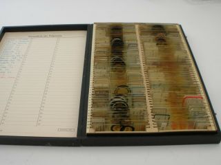 Set Of 100 Antique / Vintage Microscope Slides.  Pathology,  Histology.
