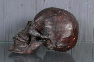 Vintage Bronze Human Skull Model Sculpture Signed Statue