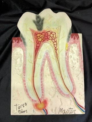 Vintage Carolina Biological Master Tooth Models Pharmaceutical Model