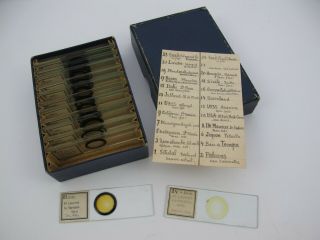 Cased Set Of 24 Antique Microscope Slides From France.  Diatoms.  With List.