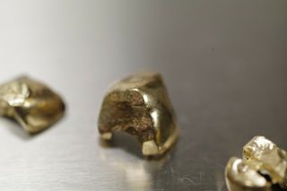 Vintage Gold Crowns Caps Teeth Dental Scrap 5 Grams 8