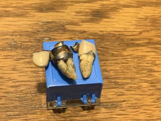 Vintage Dental Gold With Human Teeth Total Oddity For Sure Lqqk