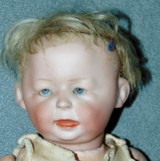 Rare Antique Bisque Doll “freddie” Needs Tlc Simon & Halbig 1428 Character Baby