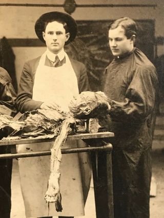 Rare Antique Medical Science Anatomy Photo Autopsy Cadaver Dissection Photograph 4