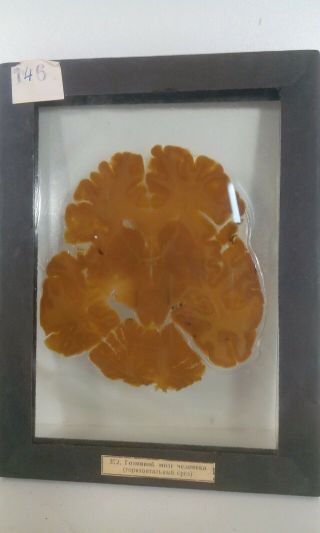 Vintage Real Human BRAIN Slice Wet SPECIMEN taxidermy biology Autopsy 2
