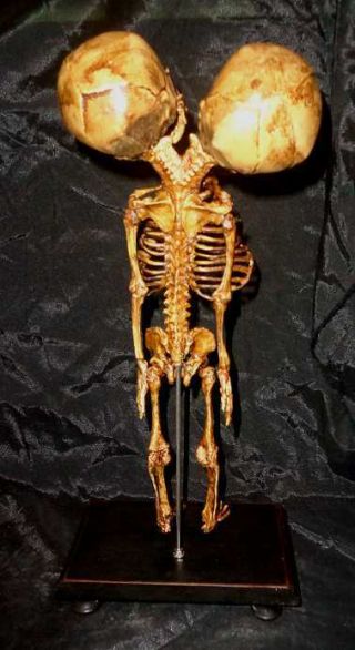 VINTAGE STYLE DOUBLE HEADED ANATOMICAL BABY FETAL SKELETON ON WOODEN STAND. 4