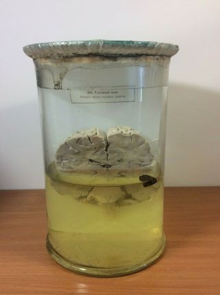 Vintage Human Brain Slice Wet Specimen (biology,  Medicine Specimen)