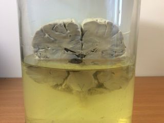 Vintage Human Brain Slice Wet Specimen (Biology,  Medicine Specimen) 4