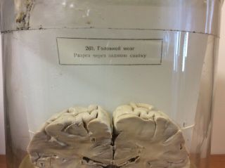 Vintage Human Brain Slice Wet Specimen (Biology,  Medicine Specimen) 5