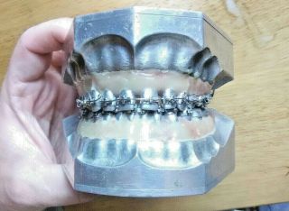 Vtg Antique Columbia Dentoform Metal Dental Model W/ Braces - Steampunk Oddity ░